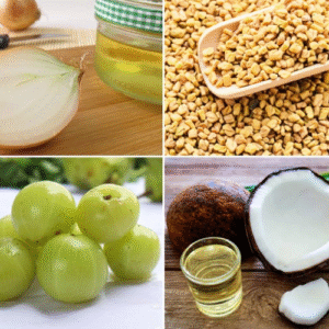 Read more about the article How to Stop Hair Fall Naturally: 10 Proven Home Remedies